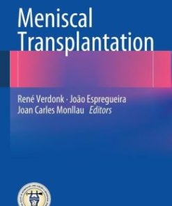 Meniscal Transplantation (PDF)