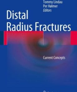 Distal Radius Fractures: Current Concepts (PDF)