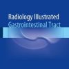 Radiology Illustrated: Gastrointestinal Tract Radiology Illustrated: Gastrointestinal Tract