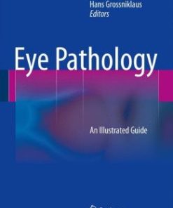 Eye Pathology: An Illustrated Guide (EPUB)