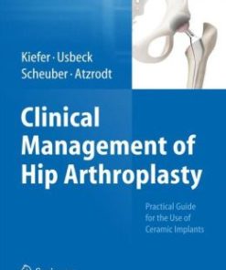 Clinical Management of Hip Arthroplasty: Practical Guide for the Use of Ceramic Implants (PDF)