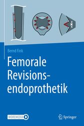 Femorale Revisionsendoprothetik (PDF)