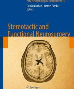 Stereotactic and Functional Neurosurgery (PDF)