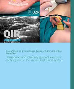 Ultrasound and clinically guided Injection techniques on the musculoskeletal system (EPUB)