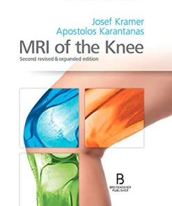 MRI of the Knee: Second revised & expanded edition (PDF)