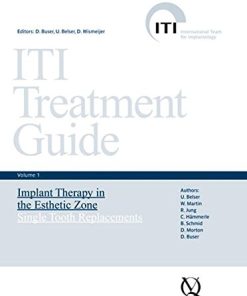 ITI Treatment Guide, Volume 1: Implant Therapy in the Esthetic Zone for Single-tooth Replacements (EPUB)