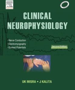 Clinical Neurophysiology, 2nd Edition