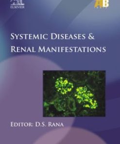 Systemic Diseases & Renal Manifestations – ECAB