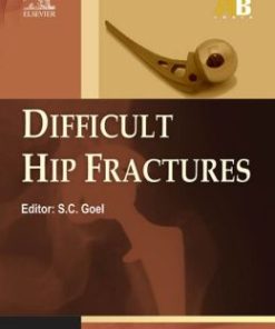 Difficult Hip Fracture – ECAB