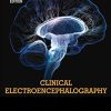 Clinical Electroencephalography, 2e (PDF)