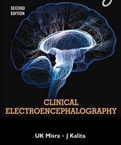 Clinical Electroencephalography, 2e (PDF)