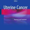 Uterine Cancer: Diagnosis and Treatment (EPUB)