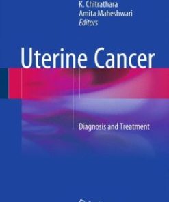 Uterine Cancer: Diagnosis and Treatment (EPUB)