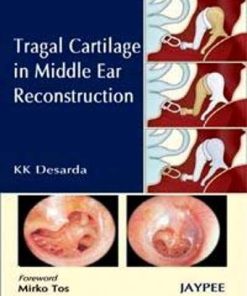 Tragal Cartilage in Middle Ear Reconstruction (Converted PDF)