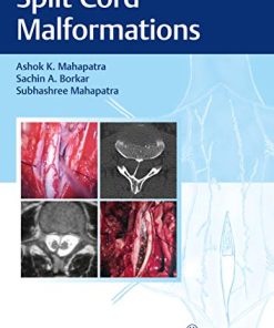 Split Cord Malformations, 2nd edition (PDF)