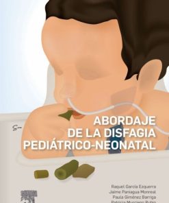 Abordaje de la disfagia pediátrico-neonatal (PDF)