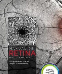 Manual de retina médica y quirúrgica (Spanish Edition) (PDF)