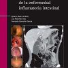 Diagnóstico diferencial de la enfermedad inflamatoria intestinal (Spanish Edition) (PDF)