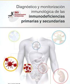 Diagnóstico y monitorización inmunológica de las inmunodeficiencias primarias y secundaria (Spanish Edition) (EPUB)