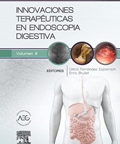 Innovaciones terapeuticas en endoscopia digestiva