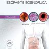 Esofagitis eosinofílica: Clínicas Iberoamericanas de Gastroenterología y Hepatología (Spanish Edition) (PDF)