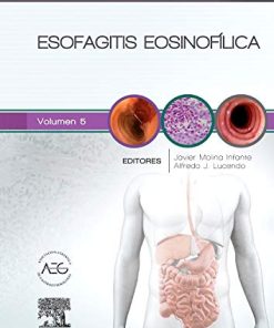 Esofagitis eosinofílica: Clínicas Iberoamericanas de Gastroenterología y Hepatología (Spanish Edition) (PDF)