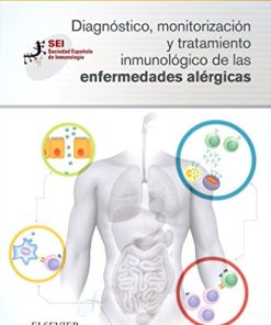 Diagnóstico, monitorización y tratamiento inmunológico de las enfermedades alérgicas (Spanish Edition) (EPUB)