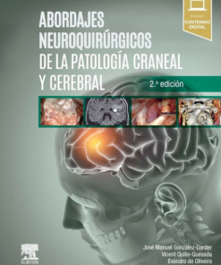 Abordajes neuroquirúrgicos de la patología craneal y cerebral, 2.ª edición (PDF)