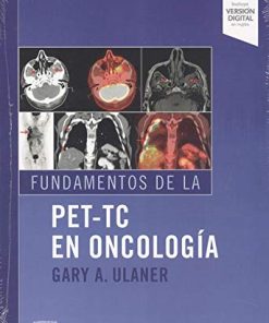 Fundamentos de la PET-TC en oncología (Spanish Edition) (PDF)