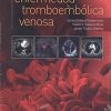 Compendio de enfermedad tromboembólica venosa (Spanish Edition) (PDF)