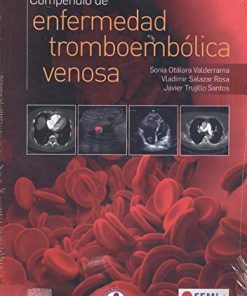 Compendio de enfermedad tromboembólica venosa (Spanish Edition) (PDF)