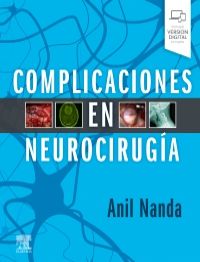 Complicaciones en neurocirugía 1st Edition (PDF)