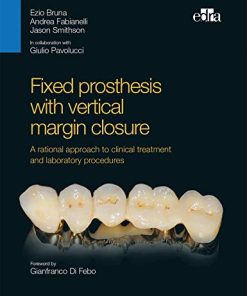 Fixed prosthesis with vertical margin closure. A rational approach to clinical treatment and laboratory procedures (EPUB)