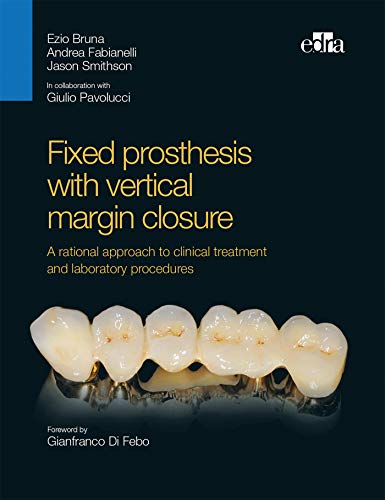 Fixed prosthesis with vertical margin closure. A rational approach to clinical treatment and laboratory procedures (EPUB) Fixed prosthesis with vertical margin closure. A rational approach to clinical treatment and laboratory procedures (EPUB)