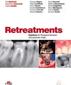 Retreatments. Solutions for Periapical Diseases of Endodontic Origin (EPUB)