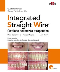 Integrated straight wire. Gestione del mezzo terapeutico (EPUB)