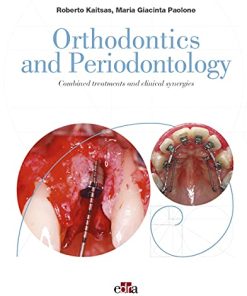 Orthodontics and Periodontology: Combined treatments and clinical synergies (azw3+epub+Converted PDF)