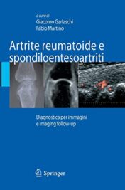 Artrite reumatoide e spondiloentesoartriti: Diagnostica Per Immagini Ed Imaging Follow-Up 2007 Original PDF Artrite reumatoide e spondiloentesoartriti: Diagnostica Per Immagini Ed Imaging Follow-Up 2007 Original PDF