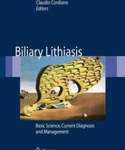 Biliary Lithiasis: Basic Science, Current Diagnosis and Management (PDF)