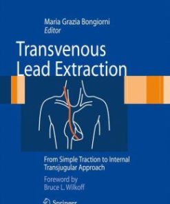 Transvenous Lead Extraction: From Simple Traction to Internal Transjugular Approach (EPUB)