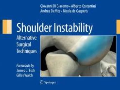 Shoulder Instability: Alternative Surgical Techniques (PDF)