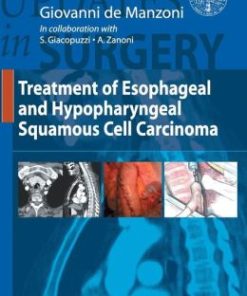 Treatment of Esophageal and Hypopharingeal Squamous Cell Carcinoma (EPUB)