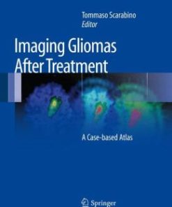 Imaging Gliomas After Treatment: A Case-based Atlas (EPUB)