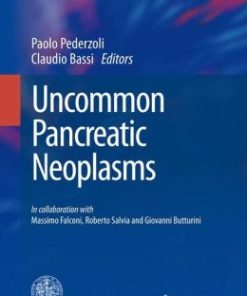 Uncommon Pancreatic Neoplasms (EPUB)