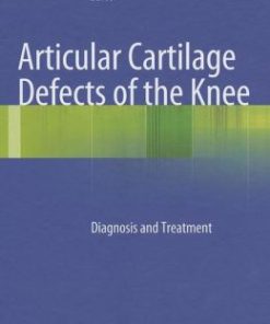 Articular Cartilage Defects of the Knee: Diagnosis and Treatment (PDF)