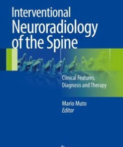 Interventional Neuroradiology of the Spine: Clinical Features, Diagnosis and Therapy (PDF)