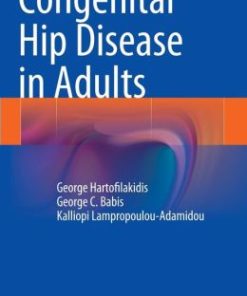 Congenital Hip Disease in Adults (EPUB)