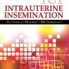 IUI Intrauterine Insemination (PDF)