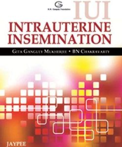 IUI Intrauterine Insemination (PDF)