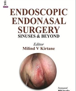 Functional Endoscopic Sinus Surgery (Endoscopic Endonasal Surgery Sinuses & Beyond: Sinuses and Beyond) (PDF)